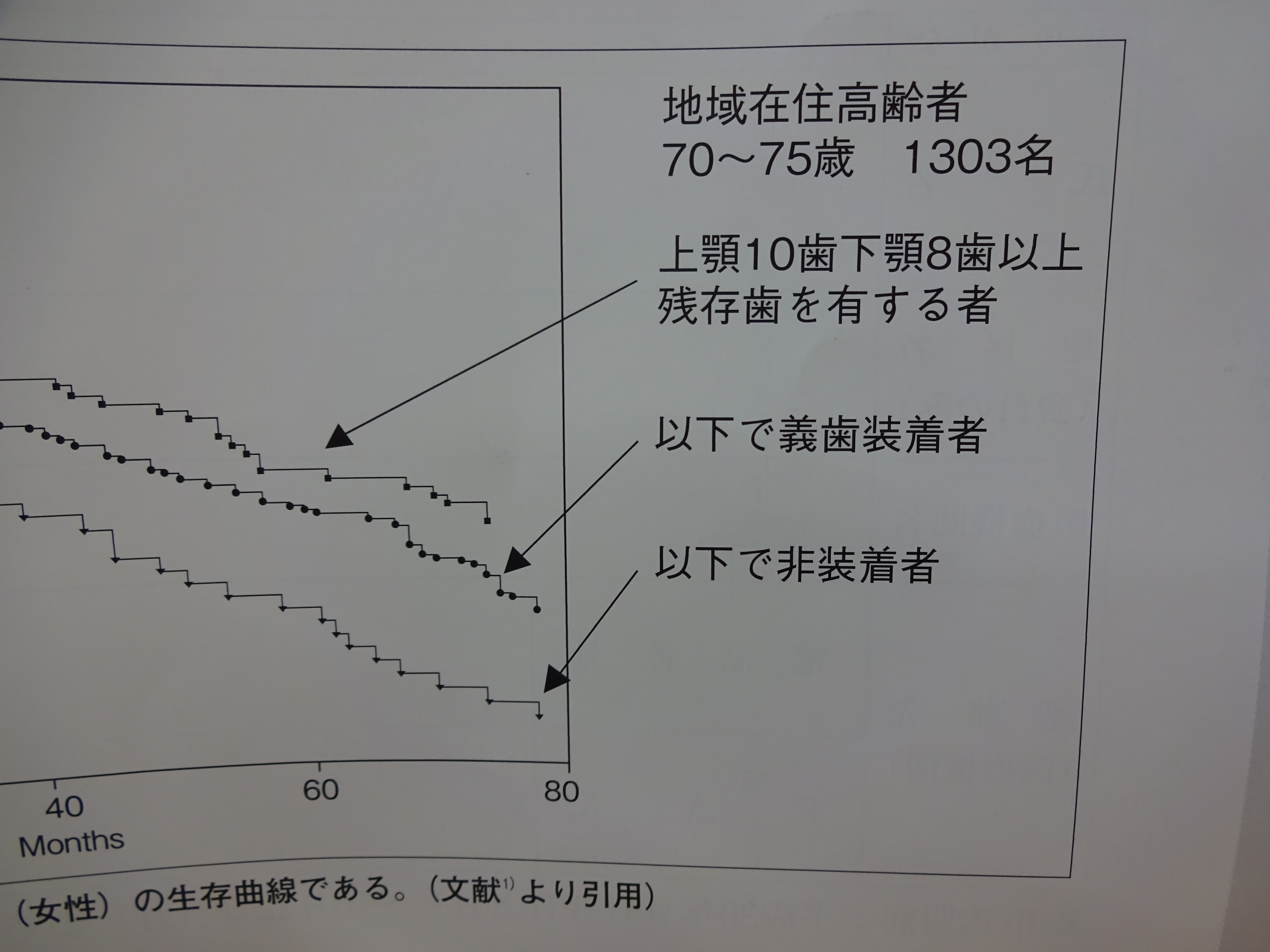 総入れ歯