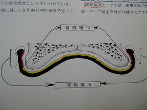 総入れ歯の維持