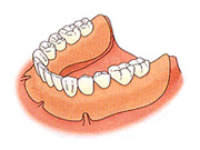 総入れ歯