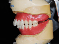 快適機能義歯排列